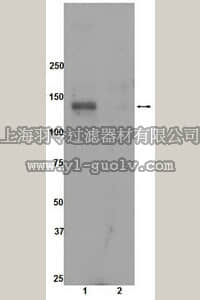 merck millipore,默克密理博,09-142,Anti-phospho-ACK1 (Tyr284) Antibody