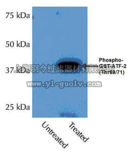 merck millipore,默克密理博,09-272,Anti-phospho-p38α (Thr180/Tyr182) Antibody