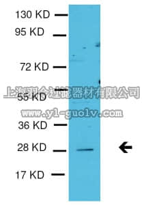 merck millipore,默克密理博,09-718,Anti-TGIF2 Antibody