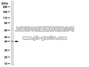 merck millipore,默克密理博,09-724,Anti-RNF110/PCGF2 Antibody merck millipore,默克密理博,09-724,Anti-RNF110/PCGF2 Antibody