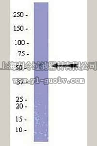 merck millipore,默克密理博,09-726,Anti-PAI-1 Antibody