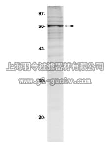 merck millipore,默克密理博,14-338,ROKα/ROCK-II Protein, active, rat, 10 µg