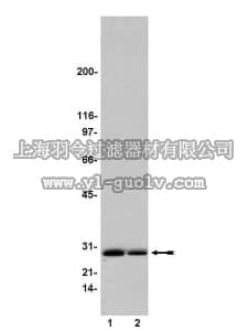 merck millipore,默克密理博,14-415,Ral Assay Reagent (Ral BP1, agarose)