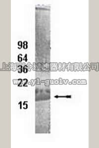 merck millipore,默克密理博,14-814,UbcH8 Conjugating Enzyme, 100 µg
