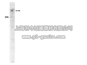 merck millipore,默克密理博,15-116,ATM/Chk2 Pathway Explorer Antibody MiniPack