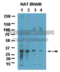 merck millipore,默克密理博,15-203,Alzheimer's Disease II - Amyloidosis Investigator Antibody  Mini-Pack