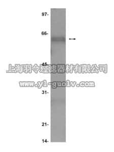 merck millipore,默克密理博,16-185,Anti-Akt/PKB Antibody, PH Domain, agarose conjugate