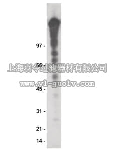 merck millipore,默克密理博,16-199,Anti-Phosphotyrosine Antibody, recombinant clone 4G10, agarose conjugate