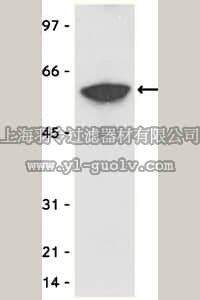 merck millipore,默克密理博,16-219,Anti-Myc Tag Antibody, clone 4A6, agarose conjugate