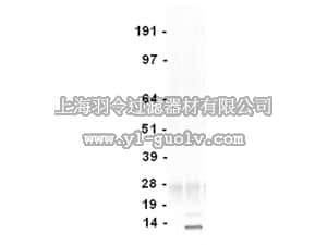 merck millipore,默克密理博,16-272,Anti-acetyl Lysine Antibody, clone 4G12, agarose conjugate