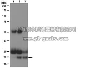merck millipore,默克密理博,16-637,Anti-Rac1 Antibody, clone 23A8, Agarose conjugate