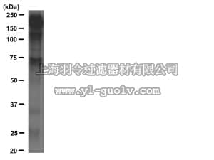merck millipore,默克密理博,16-638,4G10 Platinum, Anti-Phosphotyrosine Antibody, Agarose Conjugate