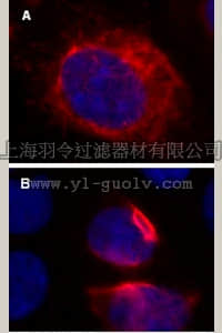 merck millipore,默克密理博,17-10153,LentiBrite ™ RFP-Vimentin Lentiviral Biosensor