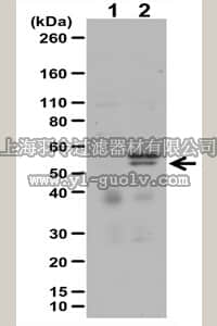 merck millipore,默克密理博,17-10400,Anti-phospho-MLKL (Ser358) Antibody Set