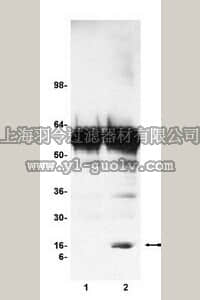 merck millipore,默克密理博,17-295,Chromatin Immunoprecipitation (ChIP) Assay Kit
