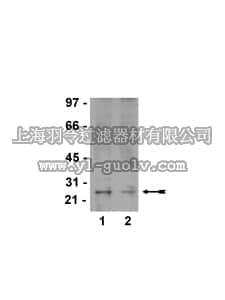 merck millipore,默克密理博,17-300,Ral Activation Assay Kit