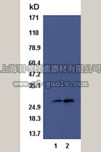 merck millipore,默克密理博,17-439,RalB Activation Assay Kit (non-radioactive)