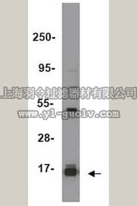 merck millipore,默克密理博,17-622,ChIPAb+ Trimethyl-Histone H3 (Lys27) - ChIP Validated Antibody and Primer Set