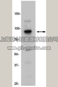 merck millipore,默克密理博,17-661,ChIPAb+ SUZ12 - ChIP Validated Antibody and Primer Set