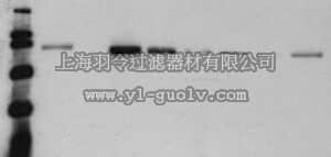 merck millipore,默克密理博,219350,Anti-β-Catenin, Dephospho Mouse mAb (8E4)