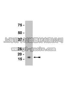 merck millipore,默克密理博,36-009,Anti-β-Synuclein Antibody, clone Syn207