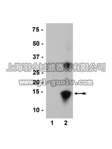 merck millipore,默克密理博,36-012,Anti-nitro-α/β-Synuclein (Tyr39) Antibody, clone nSyn14