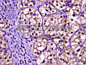 merck millipore,默克密理博,AB10025,Anti-Ubiquitin-conjugating enzyme E2 N Antibody