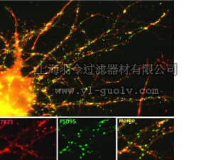 merck millipore,默克密理博,AB10140,Anti-Drebrin A/E Antibody