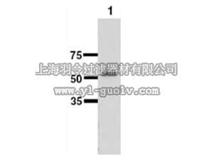 merck millipore,默克密理博,AB10339,Anti-UGT1a1 Antibody