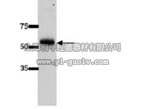 merck millipore,默克密理博,AB10343,Anti-UGT2B7 Antibody (UDP-Glycosyltransferase 2B family, polypeptide 7)