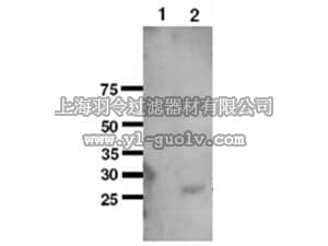 merck millipore,默克密理博,AB10346,Anti-SOD2 Antibody
