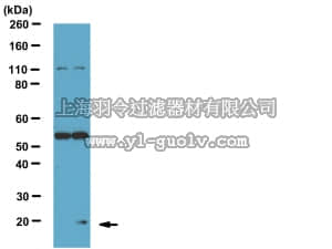 merck millipore,默克密理博,AB10423,Anti-Phospho- Bad (Ser75) Antibody