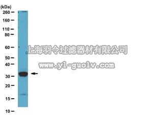 merck millipore,默克密理博,AB10428,Anti-Kallikrein-3 (KLK3) (CT) Antibody