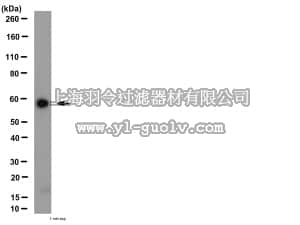 merck millipore,默克密理博,AB10516,Anti-Angiopoietin-1 Antibody merck millipore,默克密理博,AB10516,Anti-Angiopoietin-1 Antibody