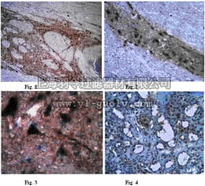 merck millipore,默克密理博,AB10545,Anti-TIGAR Antibody