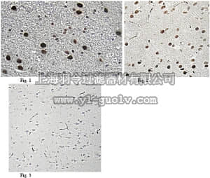 merck millipore,默克密理博,AB10546,Anti-Bcl-2-associated transcription factor 1 Antibody