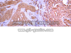 merck millipore,默克密理博,AB10911,Anti-Osteocalcin Antibody