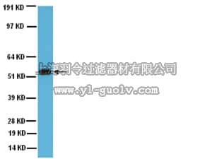 merck millipore,默克密理博,AB1252,Anti-Cytochrome P450 Enzyme CYP2E1 Antibody