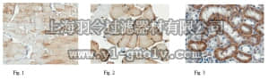 merck millipore,默克密理博,AB1286-I,Anti-Monocarboxylate Transporter 1 Antibody