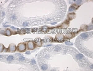 merck millipore,默克密理博,AB1296,Anti-11-β-Hydroxysteroid Dehydrogenase Type II Antibody