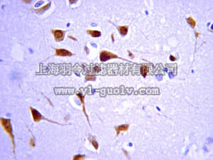 merck millipore,默克密理博,AB143,Anti-Choline Acetyltransferase (ChAT) Antibody