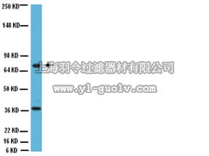 merck millipore,默克密理博,AB144P-200UL,Anti-Choline Acetyltransferase Antibody