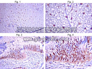 merck millipore,默克密理博,AB15014,Anti-Glycine Receptor α3 subunit Antibody