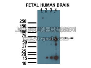 merck millipore,默克密理博,AB15242,Anti-zDHHC8 Antibody