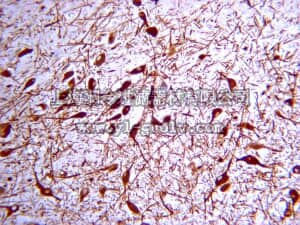 merck millipore,默克密理博,AB152,Anti-Tyrosine Hydroxylase Antibody