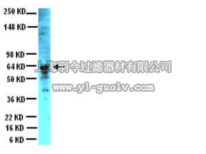 merck millipore,默克密理博,AB1530,Anti-Peripherin Antibody