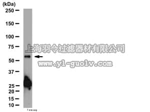 merck millipore,默克密理博,AB15325,Anti-Nicotinic Acetylcholine Receptor β2 Antibody