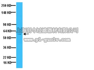 merck millipore,默克密理博,AB1542,Anti-Tyrosine Hydroxylase Antibody merck millipore,默克密理博,AB1542,Anti-Tyrosine Hydroxylase Antibody