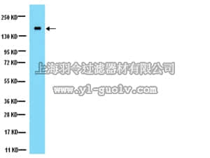 merck millipore,默克密理博,AB1555P,Anti-NMDAR2A Antibody
