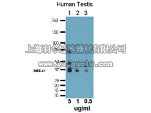 merck millipore,默克密理博,AB15632,Anti-Hey 2/HRT2 Antibody